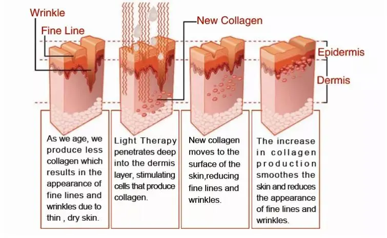 Spiral Co2 Laser Skin Resurfacing Machine